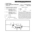 METHOD FOR THE MEDICAL IMAGING OF A BODY PART, IN PARTICULAR THE HAND diagram and image