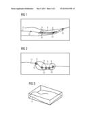 METHOD FOR THE MEDICAL IMAGING OF A BODY PART, IN PARTICULAR THE HAND diagram and image