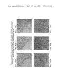 COMPOSITIONS COMPRISING MODIFIED COLLAGEN AND USES THEREFOR diagram and image