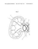 APPARATUS AND METHOD FOR RADIATION TREATMENT OF A DESIRED AREA IN THE     RENAL VASCULAR SYSTEM OF A PATIENT diagram and image