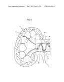 APPARATUS AND METHOD FOR RADIATION TREATMENT OF A DESIRED AREA IN THE     RENAL VASCULAR SYSTEM OF A PATIENT diagram and image