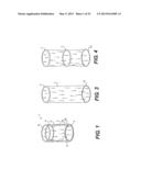 WOUND RETRACTOR DEVICE diagram and image