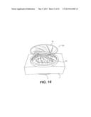 WOUND RETRACTOR DEVICE diagram and image