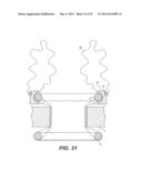 WOUND RETRACTOR DEVICE diagram and image