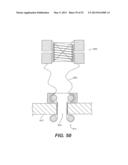 WOUND RETRACTOR DEVICE diagram and image