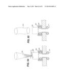 WOUND RETRACTOR DEVICE diagram and image