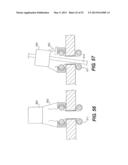 WOUND RETRACTOR DEVICE diagram and image