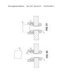 WOUND RETRACTOR DEVICE diagram and image