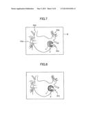 MEDICAL DIAGNOSTIC IMAGING APPARATUS diagram and image