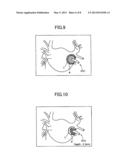 MEDICAL DIAGNOSTIC IMAGING APPARATUS diagram and image