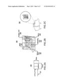 IMPLANTABLE IMAGING ARRANGEMENT AND METHOD FOR USING THE SAME diagram and image