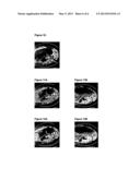 X-RAY IMAGING AT LOW CONTRAST AGENT CONCENTRATIONS AND/OR LOW DOSE     RADIATION diagram and image