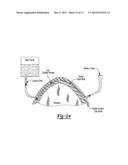 LOCAL COMPRESSION DURING AUTOMATED ULTRASOUND SCANNING AND METHODS OF     ACOUSTIC COUPLING diagram and image