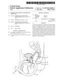 Method and Apparatus for Treating Pelvic Pain diagram and image