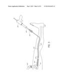 ENHANCED ULTRASOUND VISUALIZATION OF INTRAVASCULAR DEVICES diagram and image