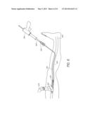 ENHANCED ULTRASOUND VISUALIZATION OF INTRAVASCULAR DEVICES diagram and image