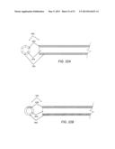 ENHANCED ULTRASOUND VISUALIZATION OF INTRAVASCULAR DEVICES diagram and image