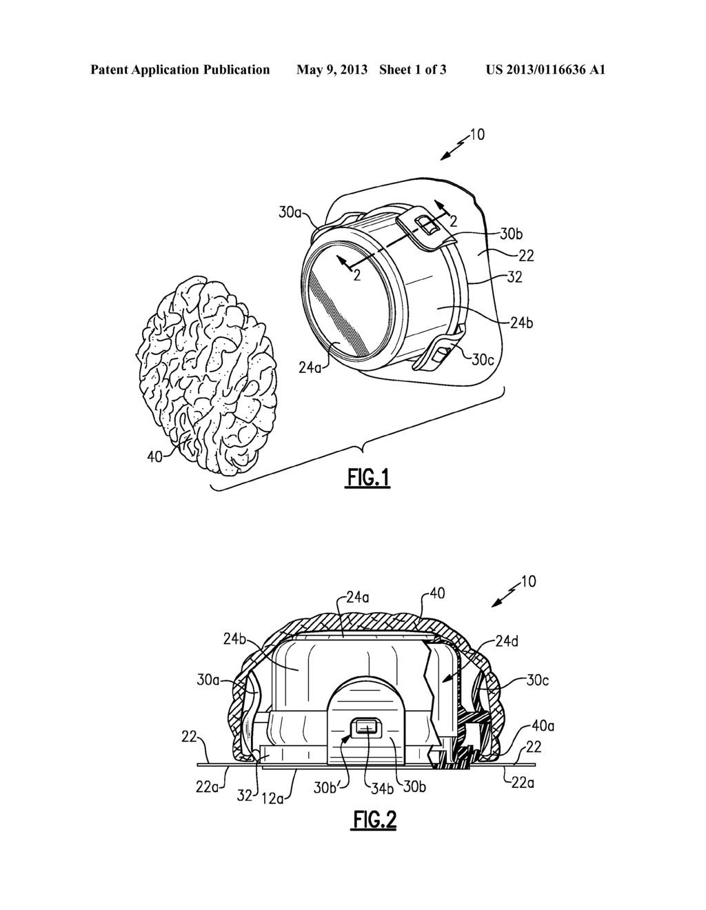 Ostomy Appliance and Method - diagram, schematic, and image 02