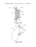 OSTOMY PORT GAS RELEASE MECHANISM diagram and image