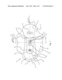 ABSORBENT ARTICLE WITH DUAL CORE diagram and image