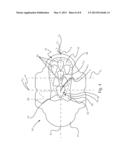 ABSORBENT ARTICLE WITH DUAL CORE diagram and image