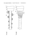 CATHETER AND METHOD diagram and image