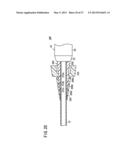 CATHETER AND METHOD diagram and image