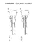 CATHETER AND METHOD diagram and image