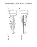 CATHETER AND METHOD diagram and image