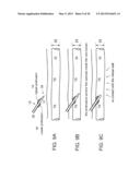 CATHETER CANNULA WITH ANCHORING ELEMENTS, CATHETER INCLUDING THEREOF,     AND/OR CATHETERIZATION METHOD USING diagram and image