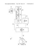 RETINAL LASER SURGERY diagram and image