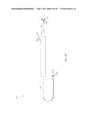 STEERABLE LASER PROBE diagram and image