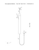 STEERABLE LASER PROBE diagram and image