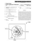 GRID PATTERN LASER TREATMENT AND METHODS diagram and image