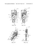 GRID PATTERN LASER TREATMENT AND METHODS diagram and image