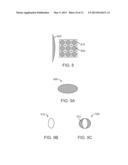 GRID PATTERN LASER TREATMENT AND METHODS diagram and image