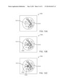 GRID PATTERN LASER TREATMENT AND METHODS diagram and image