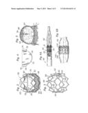 METHODS OF CONDITIONING SHEET BIOPROSTHETIC TISSUE diagram and image