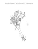 Endoscopic Vessel Sealer and Divider for Large Tissue Structures diagram and image