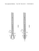 Endoscopic Vessel Sealer and Divider for Large Tissue Structures diagram and image