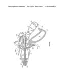 Endoscopic Vessel Sealer and Divider for Large Tissue Structures diagram and image