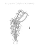 Endoscopic Vessel Sealer and Divider for Large Tissue Structures diagram and image