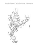 Endoscopic Vessel Sealer and Divider for Large Tissue Structures diagram and image