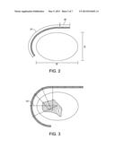 EXTERNAL FIXATION diagram and image