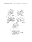 STRAIGHT INTRAMEDULLARY FRACTURE FIXATION DEVICES AND METHODS diagram and image