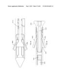 STRAIGHT INTRAMEDULLARY FRACTURE FIXATION DEVICES AND METHODS diagram and image