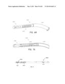 STRAIGHT INTRAMEDULLARY FRACTURE FIXATION DEVICES AND METHODS diagram and image