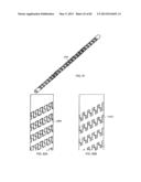 STRAIGHT INTRAMEDULLARY FRACTURE FIXATION DEVICES AND METHODS diagram and image