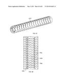 STRAIGHT INTRAMEDULLARY FRACTURE FIXATION DEVICES AND METHODS diagram and image