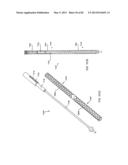 STRAIGHT INTRAMEDULLARY FRACTURE FIXATION DEVICES AND METHODS diagram and image